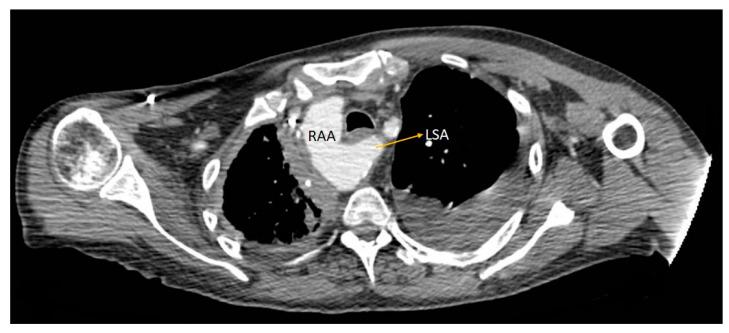 https://cdn.ncbi.nlm.nih.gov/pmc/blobs/3000/11393892/4dc905cb905c/diagnostics-14-01851-g004.jpg