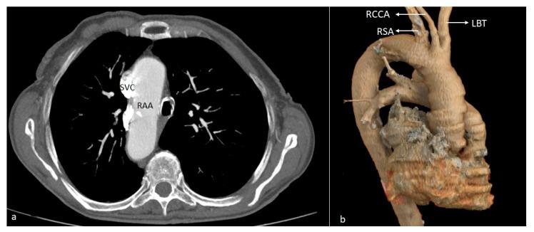 https://cdn.ncbi.nlm.nih.gov/pmc/blobs/3000/11393892/68dd2e5c889a/diagnostics-14-01851-g006.jpg