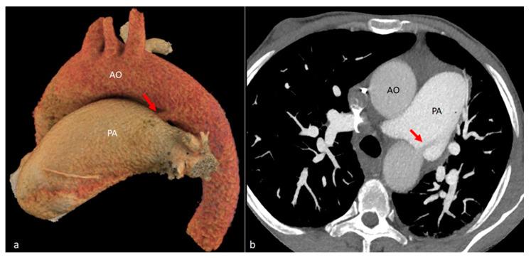 https://cdn.ncbi.nlm.nih.gov/pmc/blobs/3000/11393892/cde48cc8a9e4/diagnostics-14-01851-g011.jpg