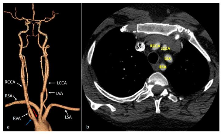 https://cdn.ncbi.nlm.nih.gov/pmc/blobs/3000/11393892/ea46c2e979e9/diagnostics-14-01851-g003.jpg