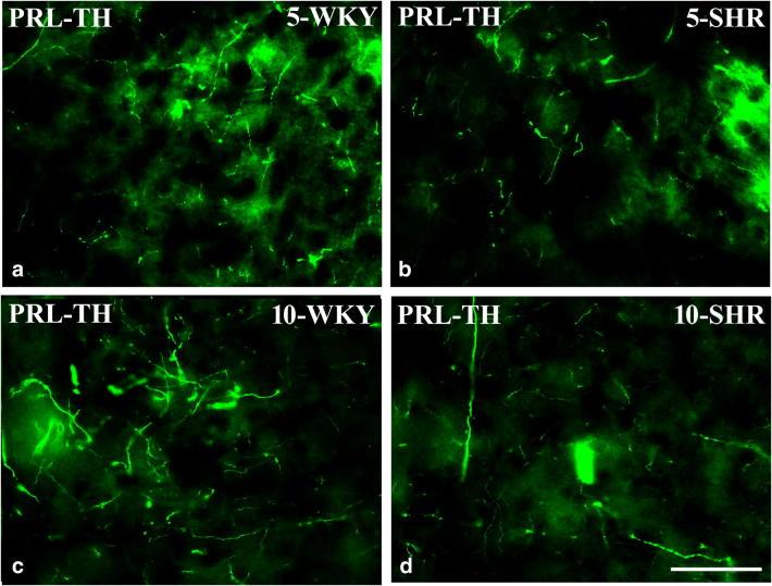 https://cdn.ncbi.nlm.nih.gov/pmc/blobs/3000/6820808/bb12c11831e4/213_2019_5180_Fig11_HTML.jpg