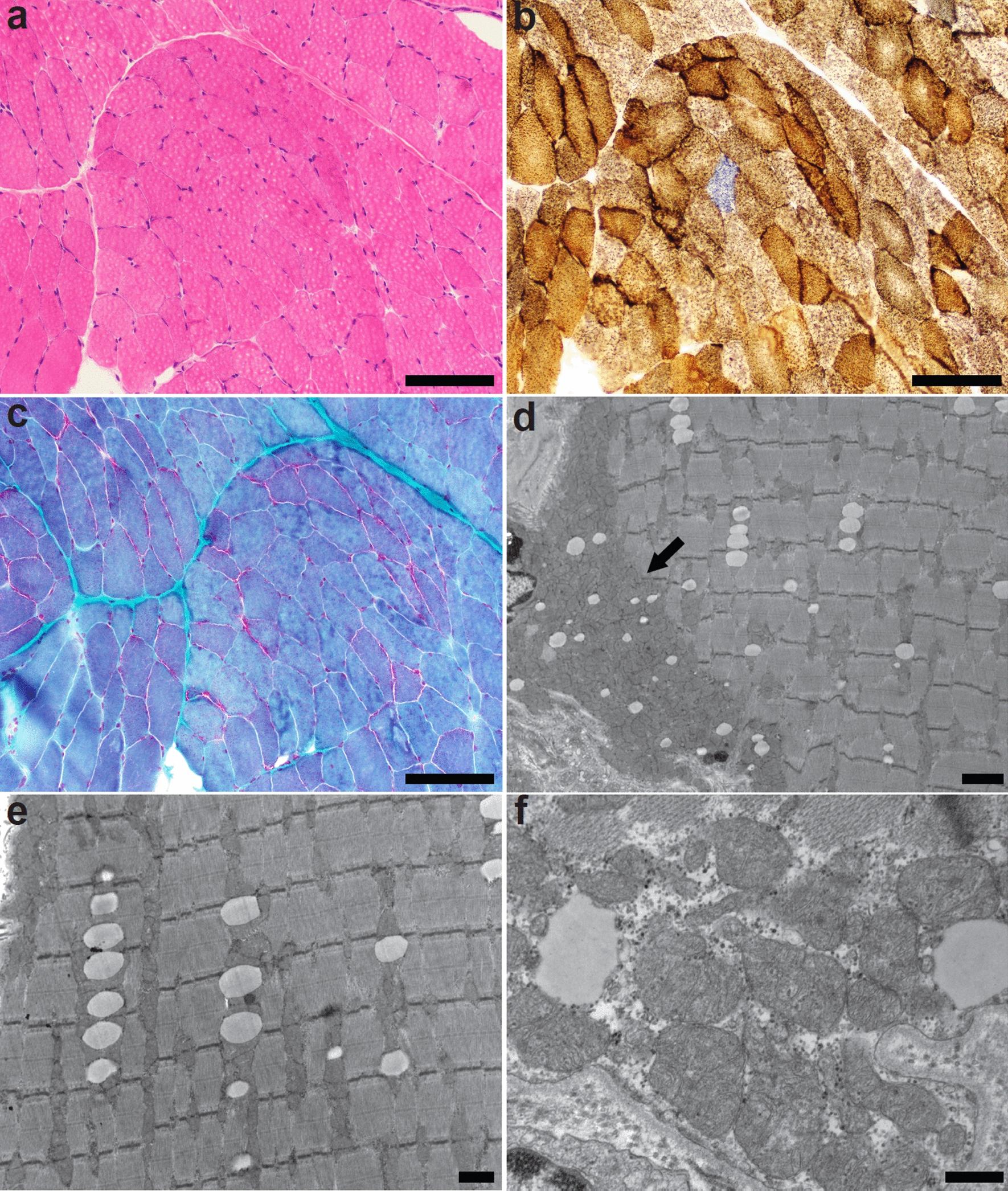 https://cdn.ncbi.nlm.nih.gov/pmc/blobs/3003/9511743/3a646bbaec64/40478_2022_1445_Fig2_HTML.jpg