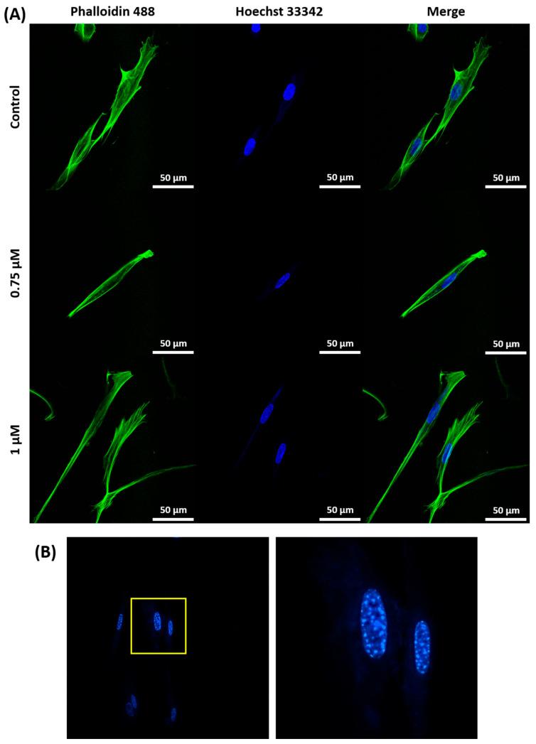 https://cdn.ncbi.nlm.nih.gov/pmc/blobs/300f/12347707/5a81cc71c28d/ijms-26-07489-g004.jpg