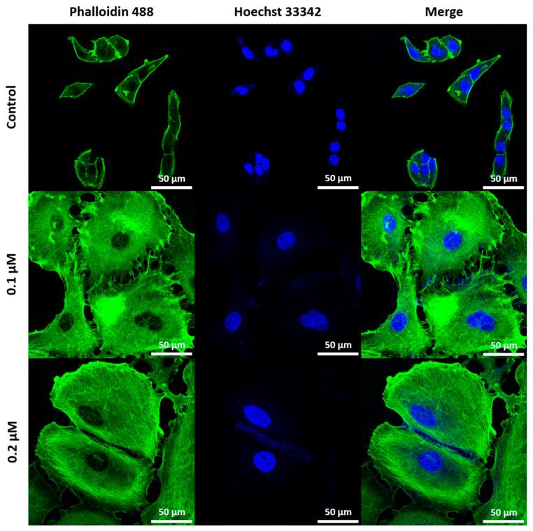 https://cdn.ncbi.nlm.nih.gov/pmc/blobs/300f/12347707/6e55fc93fb1b/ijms-26-07489-g005.jpg