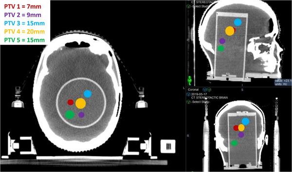 https://cdn.ncbi.nlm.nih.gov/pmc/blobs/3010/9121024/9fd49572d594/ACM2-23-e13576-g008.jpg