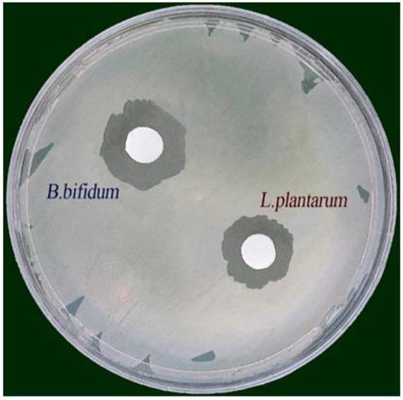 https://cdn.ncbi.nlm.nih.gov/pmc/blobs/301b/11389761/bb1c7cadd96c/IJM-16-497-g001.jpg