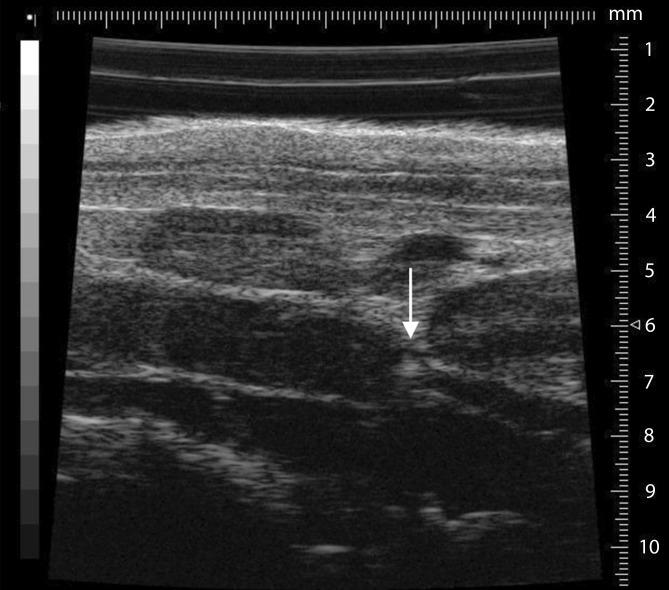 https://cdn.ncbi.nlm.nih.gov/pmc/blobs/3026/5306225/b1ab7e33d4d1/772_2016_227_Fig5_HTML.jpg