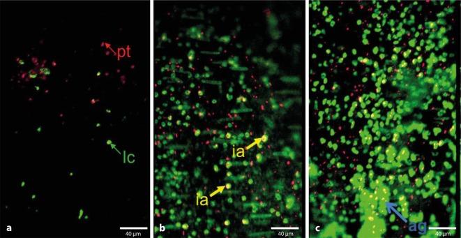 https://cdn.ncbi.nlm.nih.gov/pmc/blobs/3026/5306225/cc4cdc6a6da5/772_2016_227_Fig4_HTML.jpg
