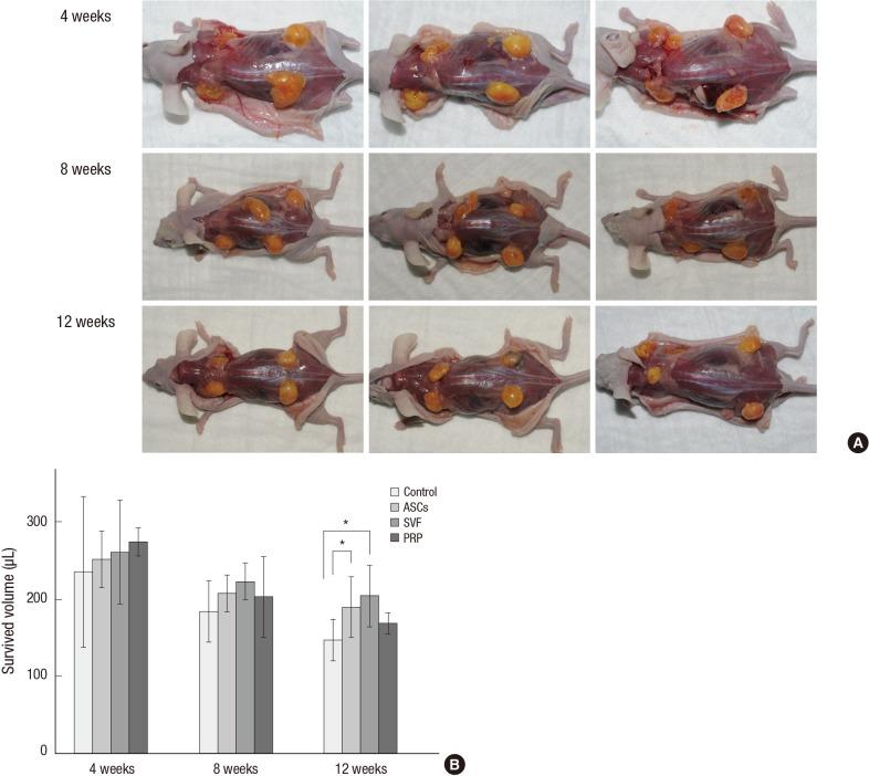 https://cdn.ncbi.nlm.nih.gov/pmc/blobs/3027/4248005/19694f045172/jkms-29-S193-g002.jpg