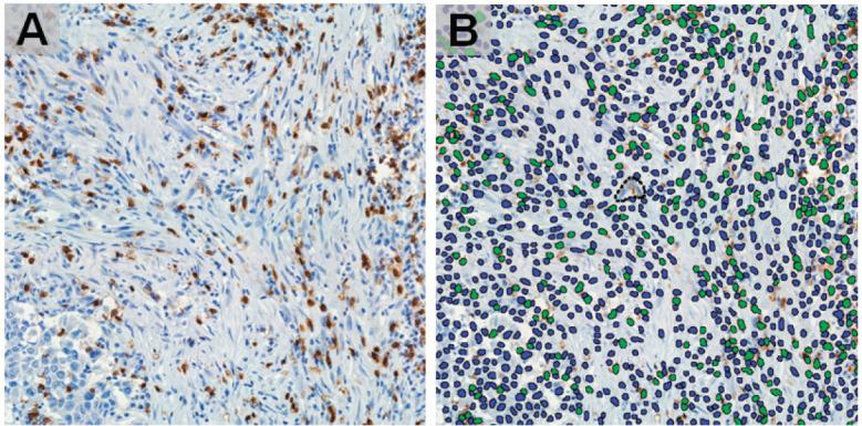 https://cdn.ncbi.nlm.nih.gov/pmc/blobs/3028/9085163/b482919add50/can-16-1362fig2.jpg