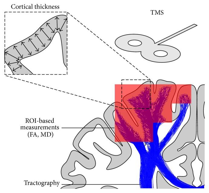 https://cdn.ncbi.nlm.nih.gov/pmc/blobs/3029/4709757/27598aa57bfc/NP2016-2643491.004.jpg