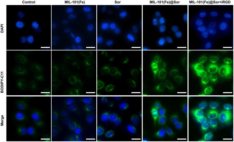 https://cdn.ncbi.nlm.nih.gov/pmc/blobs/3031/7884959/2143c9e556c8/IJN-16-1037-g0005.jpg
