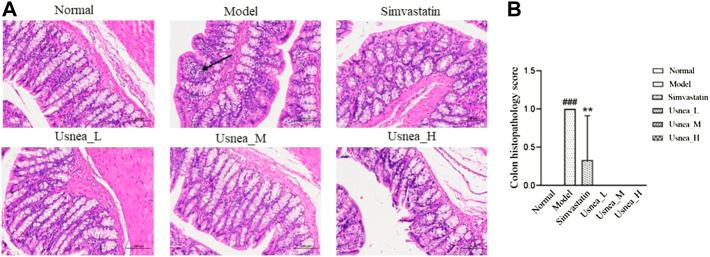 https://cdn.ncbi.nlm.nih.gov/pmc/blobs/3031/9732435/a0ad85cb4cd0/fphar-13-1064872-g004.jpg