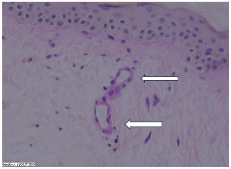 https://cdn.ncbi.nlm.nih.gov/pmc/blobs/3034/11989562/bea90f392539/jcm-14-02303-g005.jpg