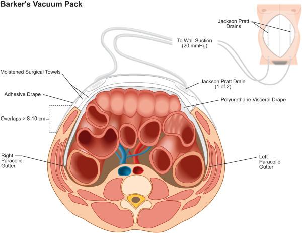 https://cdn.ncbi.nlm.nih.gov/pmc/blobs/3036/3662623/a8be62d4640a/1745-6215-14-141-4.jpg