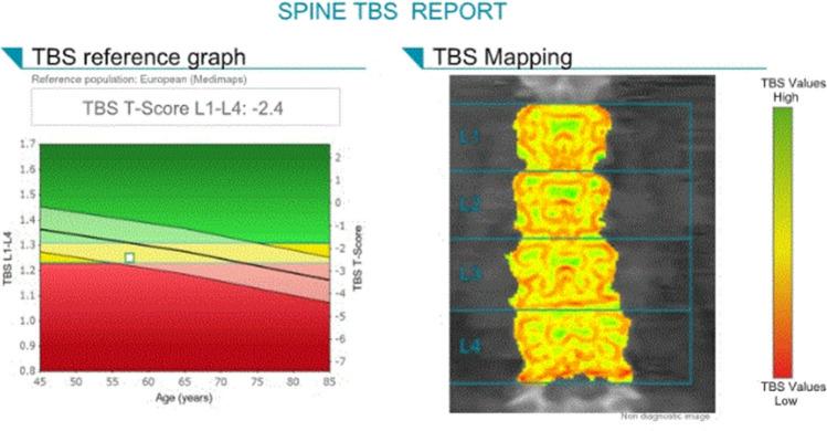 https://cdn.ncbi.nlm.nih.gov/pmc/blobs/3039/11732917/498d0328887e/259_2024_6912_Fig7_HTML.jpg