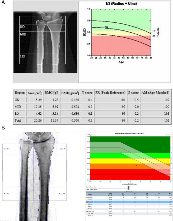 https://cdn.ncbi.nlm.nih.gov/pmc/blobs/3039/11732917/d69ce09d5627/259_2024_6912_Fig4_HTML.jpg