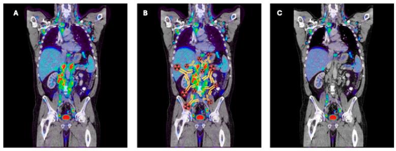 https://cdn.ncbi.nlm.nih.gov/pmc/blobs/303a/11352548/1e5cb8ef0678/cancers-16-02896-g003.jpg