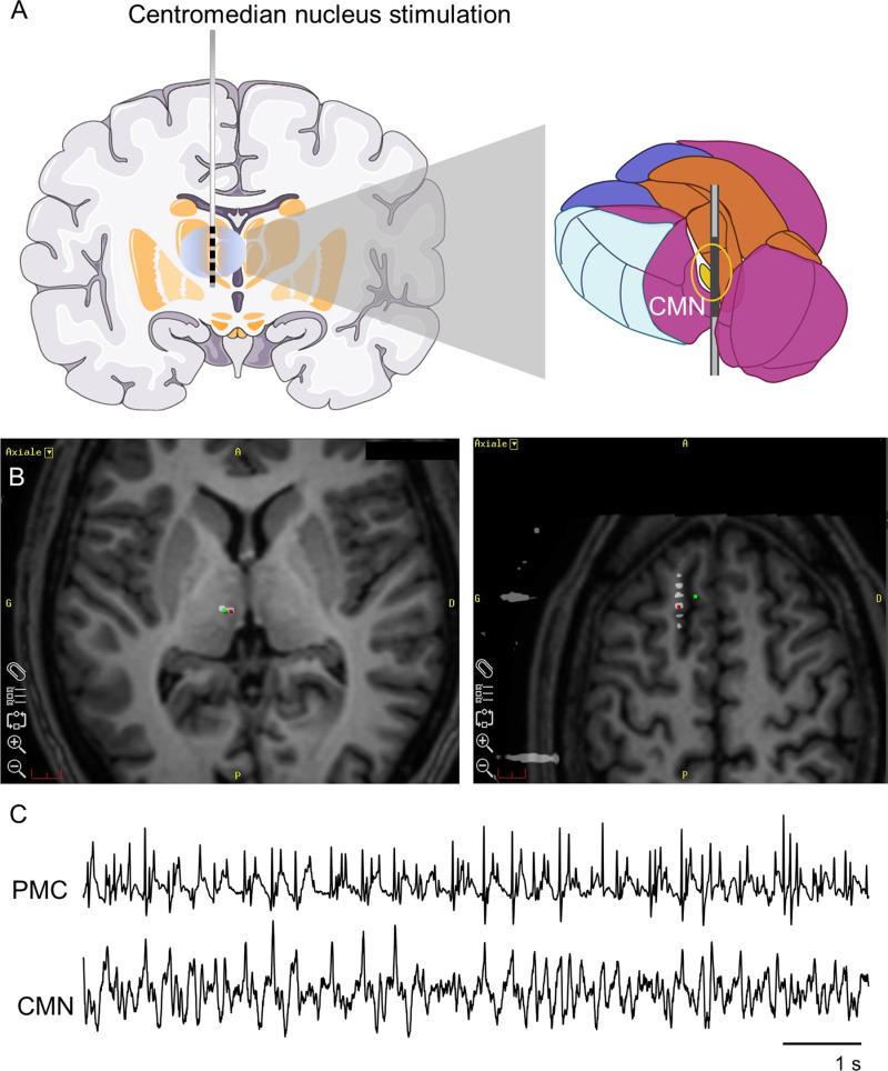 https://cdn.ncbi.nlm.nih.gov/pmc/blobs/303c/12143575/1607df943f68/pcbi.1012943.g001.jpg