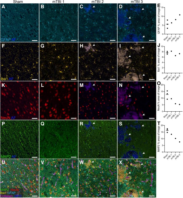 https://cdn.ncbi.nlm.nih.gov/pmc/blobs/303f/10924061/8f33457e368a/neur.2023.0105_figure2.jpg
