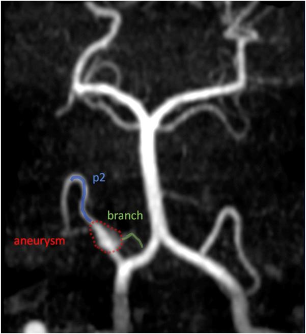 https://cdn.ncbi.nlm.nih.gov/pmc/blobs/3040/11809982/34df32018a49/neuopen-6-e00123-g002.jpg