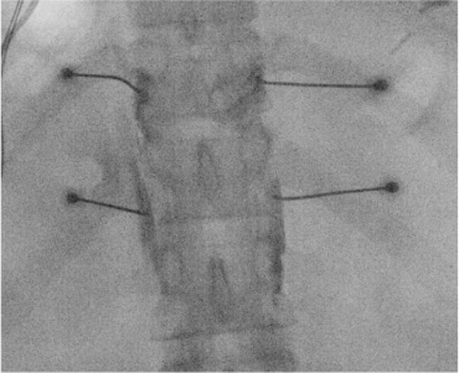 https://cdn.ncbi.nlm.nih.gov/pmc/blobs/3043/11973027/9e499094309e/PAPR-25-0-g001.jpg