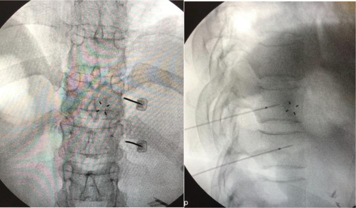 https://cdn.ncbi.nlm.nih.gov/pmc/blobs/3043/11973027/bc62d63cb735/PAPR-25-0-g005.jpg