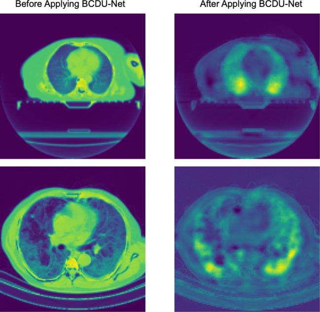 https://cdn.ncbi.nlm.nih.gov/pmc/blobs/3045/7893172/5bd3186abead/41746_2021_399_Fig2_HTML.jpg