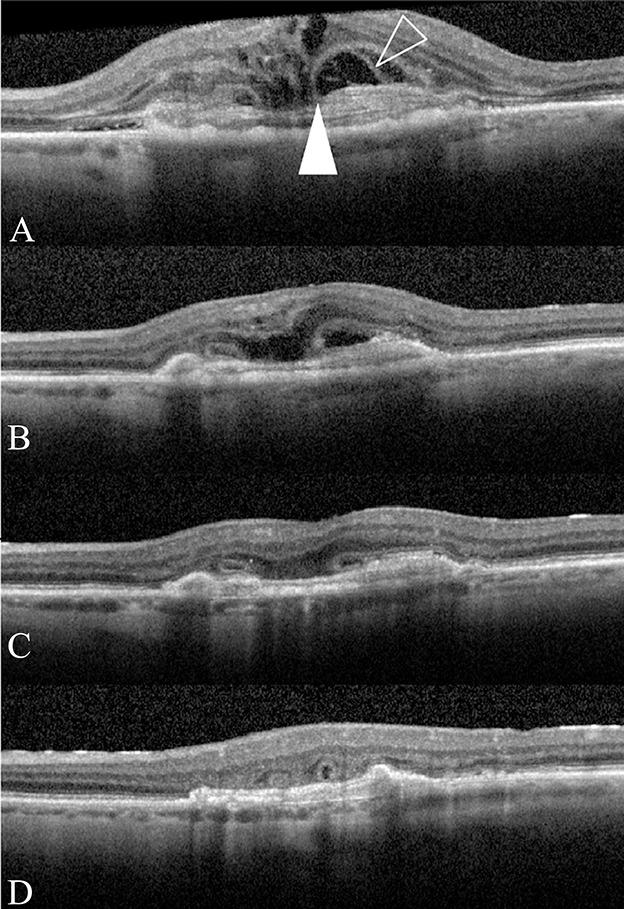 https://cdn.ncbi.nlm.nih.gov/pmc/blobs/3050/8384246/a8ad578c92c9/retina-41-1930-g002.jpg