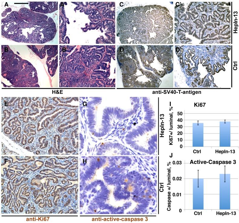 https://cdn.ncbi.nlm.nih.gov/pmc/blobs/3053/4012739/fea5836793be/oncotarget-05-1352-g005.jpg