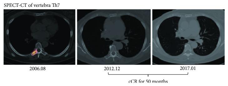 https://cdn.ncbi.nlm.nih.gov/pmc/blobs/3056/5822812/6fa80e0106fd/IJBC2018-4879406.002.jpg