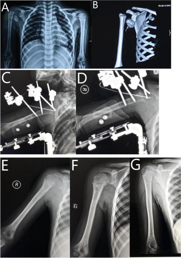 https://cdn.ncbi.nlm.nih.gov/pmc/blobs/3059/8734332/513172ebe73a/12891_2021_4992_Fig2_HTML.jpg
