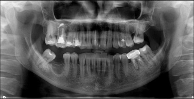 https://cdn.ncbi.nlm.nih.gov/pmc/blobs/305c/9617253/bee50cb6313b/jomr-13-e5-g001.jpg