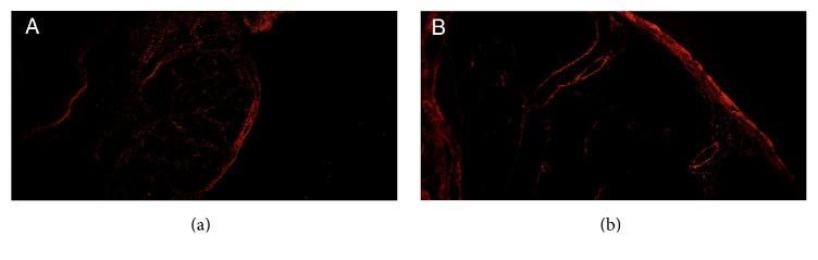 https://cdn.ncbi.nlm.nih.gov/pmc/blobs/305d/5457755/5582fd5a11d1/AU2017-3254980.003.jpg