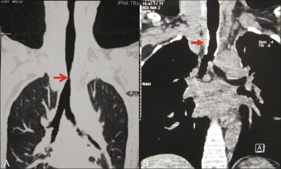 https://cdn.ncbi.nlm.nih.gov/pmc/blobs/3067/3190490/93f7e2caa559/IJRI-21-191-g006.jpg