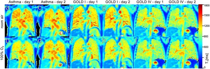 https://cdn.ncbi.nlm.nih.gov/pmc/blobs/306c/5312969/eb695542bd83/pone.0172479.g002.jpg