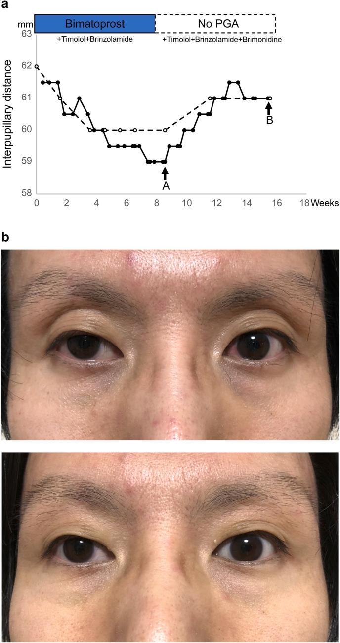 https://cdn.ncbi.nlm.nih.gov/pmc/blobs/306f/8933820/a75bcda94c59/gr2.jpg