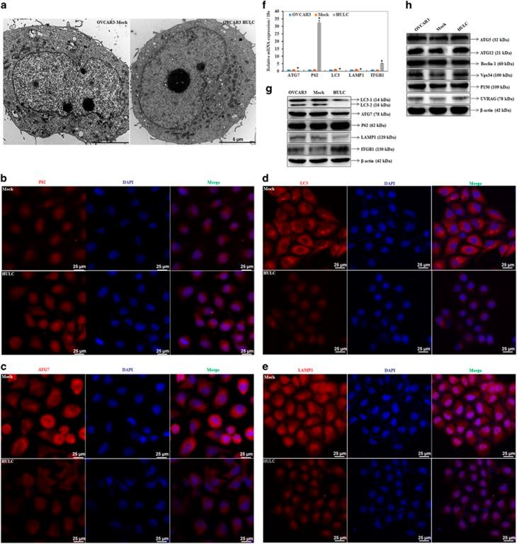 https://cdn.ncbi.nlm.nih.gov/pmc/blobs/3070/5682654/92159aa96404/cddis2017486f4.jpg