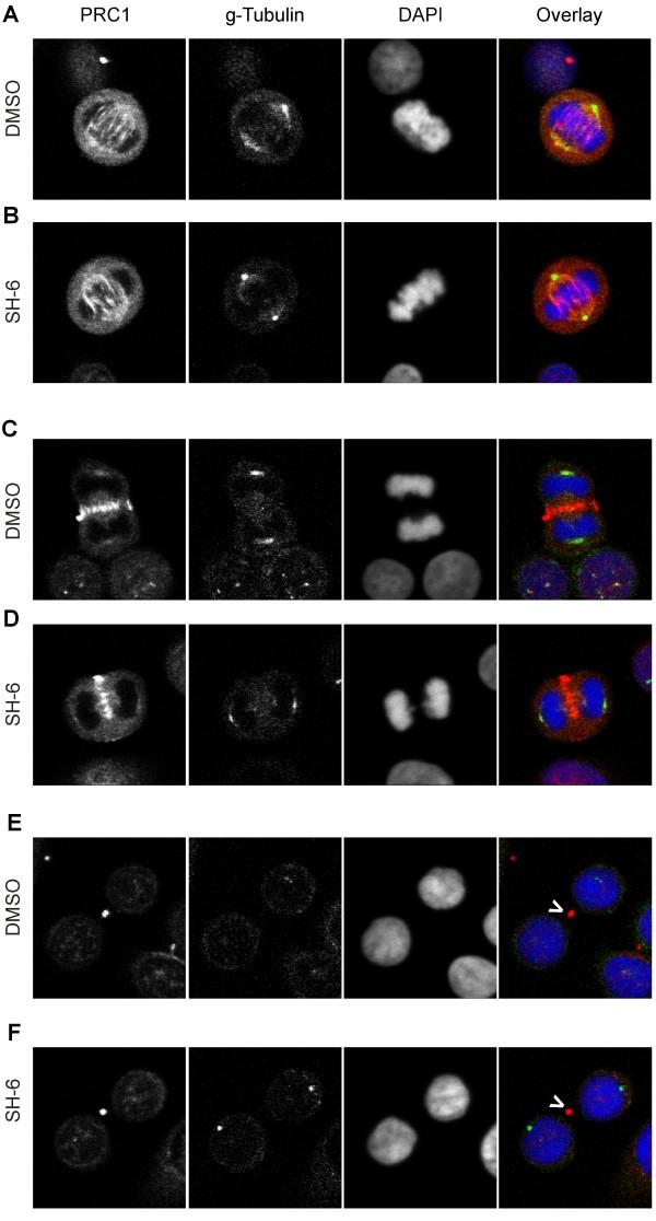 https://cdn.ncbi.nlm.nih.gov/pmc/blobs/307a/2895615/960d639067e8/1471-2407-10-287-5.jpg