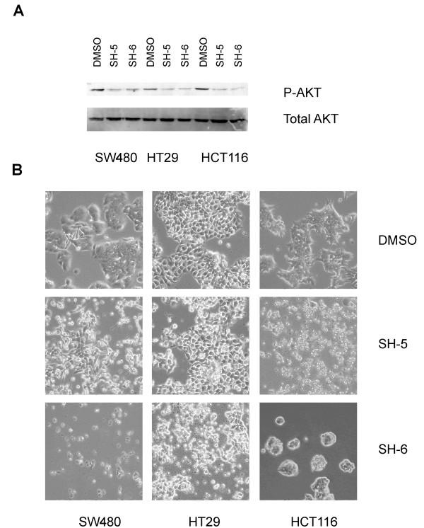 https://cdn.ncbi.nlm.nih.gov/pmc/blobs/307a/2895615/dac896f15031/1471-2407-10-287-1.jpg