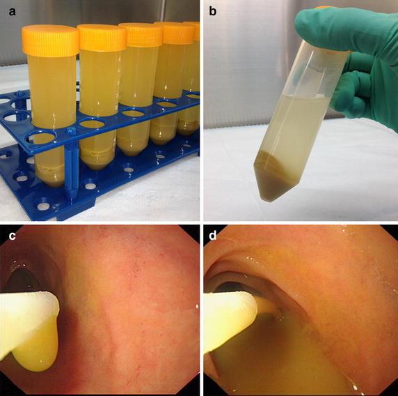 https://cdn.ncbi.nlm.nih.gov/pmc/blobs/307f/4567790/a14f6cad4f5b/12967_2015_646_Fig1_HTML.jpg