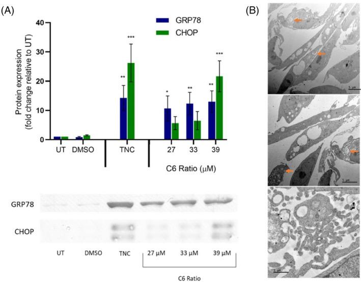 https://cdn.ncbi.nlm.nih.gov/pmc/blobs/3083/11471428/dcc3cd05fb1e/CPR-57-e13650-g005.jpg