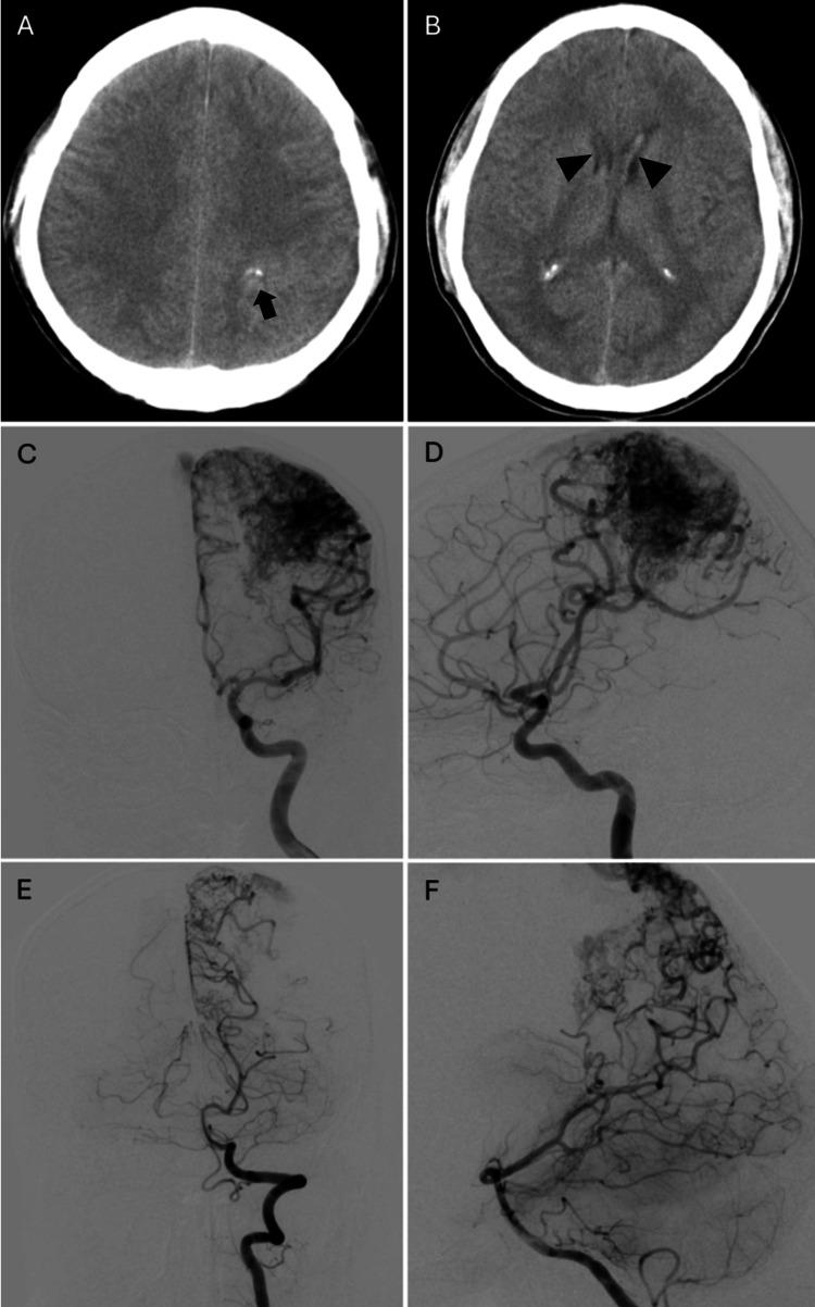 https://cdn.ncbi.nlm.nih.gov/pmc/blobs/3083/12162386/1f2679532cda/cureus-0017-00000084035-i01.jpg