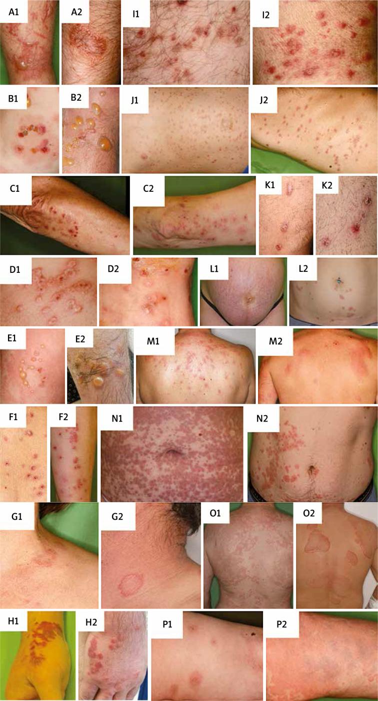 https://cdn.ncbi.nlm.nih.gov/pmc/blobs/3084/9880782/bb252ef36ae5/PDIA-38-44090-g002.jpg