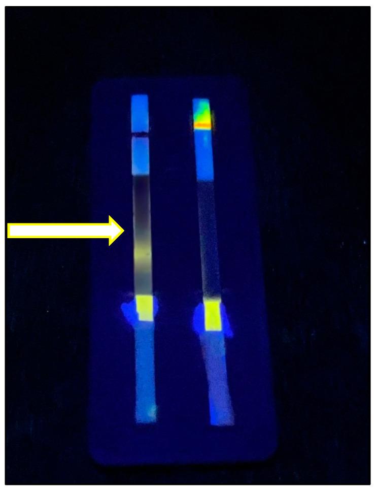 https://cdn.ncbi.nlm.nih.gov/pmc/blobs/3086/12025067/f94d7ad4ca2a/biosensors-15-00256-g011.jpg