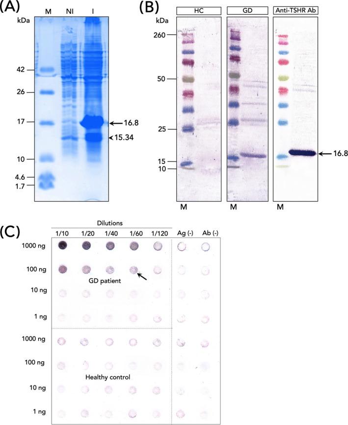 https://cdn.ncbi.nlm.nih.gov/pmc/blobs/3088/8993630/1c277e41abe1/JCLA-36-e24288-g003.jpg