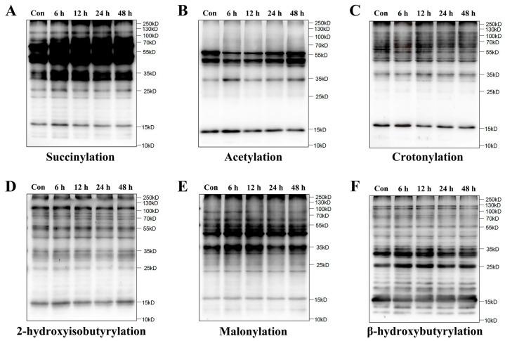 https://cdn.ncbi.nlm.nih.gov/pmc/blobs/3091/11988372/695142c0befb/ijms-26-02908-g001.jpg