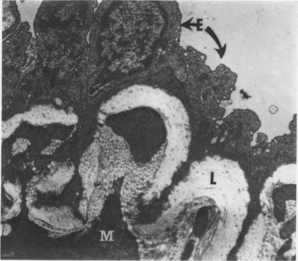 https://cdn.ncbi.nlm.nih.gov/pmc/blobs/3091/1396672/60f569033e55/annsurg00410-0014-a.jpg
