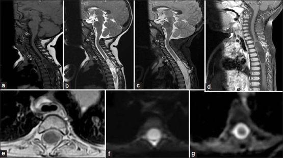 https://cdn.ncbi.nlm.nih.gov/pmc/blobs/3093/3888035/edca60c030e4/JPN-8-201-g002.jpg