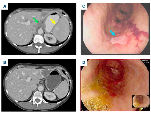 https://cdn.ncbi.nlm.nih.gov/pmc/blobs/309d/12399954/569bada17245/1102235.fig2.jpg